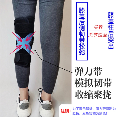 x型腿矫正器宝宝o型腿膝外翻内八字支具定做膝过伸反张鞋0人付款630