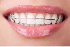 00当时年纪小0618淘宝钢丝保持器 传统哈雷  哈利氏保持器定制 隙防