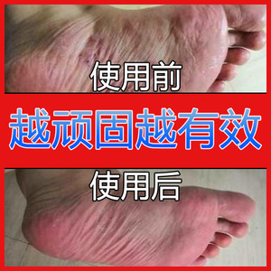 克洛星