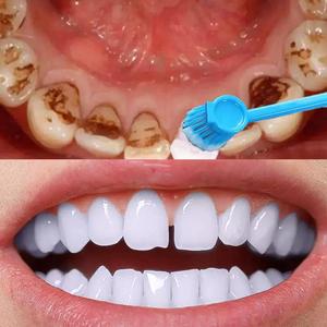 洗牙齿洗的白洗黄牙