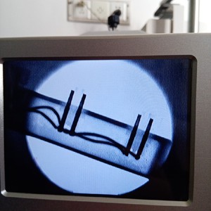 00同款货源tb830459063淘宝x光透视仪小型高清微h焦点x光机透视wj