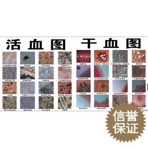 一滴血检测仪挂图 对比图验血仪彩色活血干血图大喷图验血图