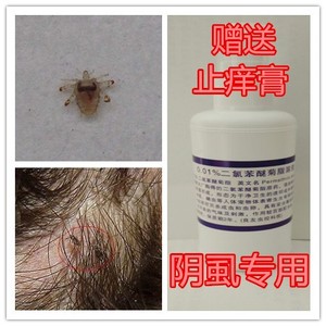 01%二氯苯醚菊脂溶液阴虱药百部酊阴痒私痒私处阴虱痒