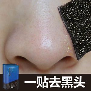 鼻贴去黑头粉刺男士女生专用吸白头收缩毛孔清洁神器撕拉式套装
