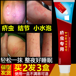 疥得治软膏虱疥一扫光疥虫螨虫硫磺软膏疥舒顽疥清疥虱康宁疥灵霜