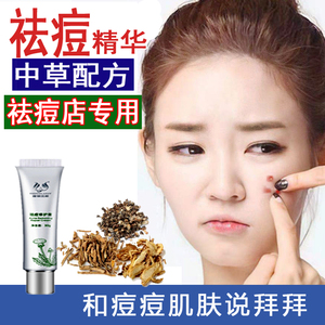 祛痘清颜霜改善痘肌修护面霜淡化痘印正品祛痘膏青春痘男士女