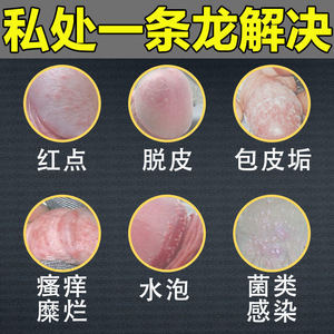 佳必德草本归严宁官网软膏正品男科龟头私处炎清洁痒归严宁男性士