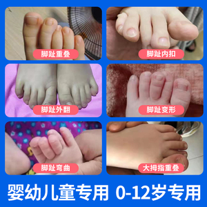 宝宝儿童大脚拇指外翻内扣脚趾矫正器小孩脚趾头弯曲重叠分趾器