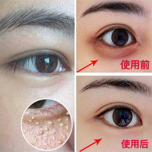 九叶草眼霜去眼袋