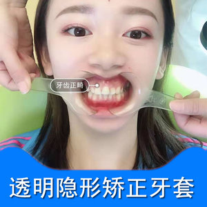 专业牙套牙齿矫正器成人隐形透明纠正儿童龅牙地包天门牙缝隙大人