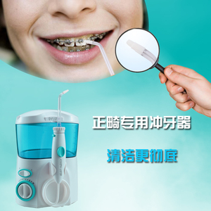 自锁牙套_传统牙套和自锁牙套_自锁牙套真的比较快吗