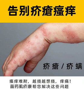 疥疮膏结节一扫光止痒去根疥虫阴虱硫磺软膏皮肤瘙痒止痒特效药膏