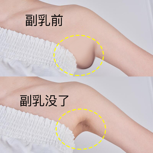 【小红书推荐去副乳神器】收副乳消除帖 淋巴散结膏 结节腋下疏通