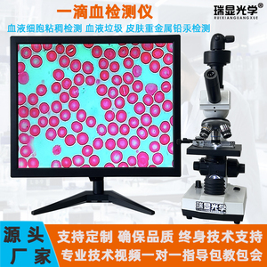 一滴血检测仪器血液带显示屏细胞粘稠结晶脂质斑块检测便携显微镜