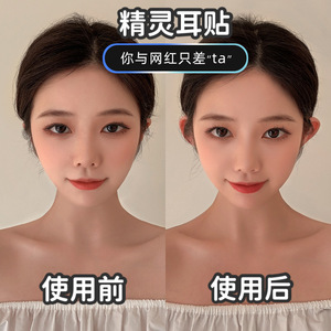 精灵耳贴神器招风耳立隐形固定贴拍照大脸显小矫正支撑器硅胶耳夹
