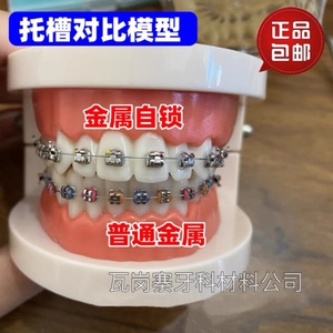 牙科口腔模型2种托槽对比模型 正畸金属自锁托槽托槽示范模型包邮