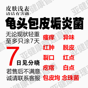 治疗龟头包皮炎症白色念珠菌性阴炎豆腐渣霉菌消炎软膏洗液的药男