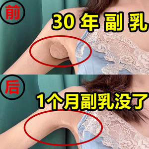 副乳消除神器贴收副乳