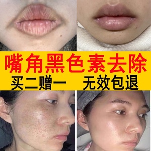 嘴角黑色素去除嘴唇旁周围发黑沉淀嘴巴周边暗沉脸部美白嘴角祛黑