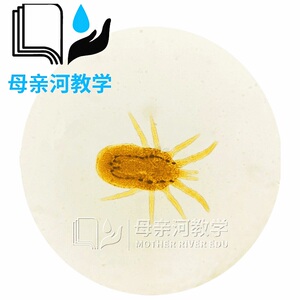 显微镜螨虫标本