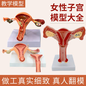 人体模型女性生殖子宫模型生殖卵巢模型教学模具病理变化科学教具
