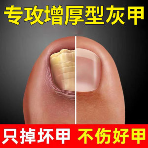 00百杏林康复坊淘宝凤仙花抑菌液一滴新亮甲灰甲净正品甲专用药菲