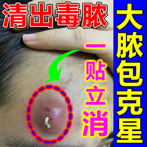 火疖子拔毒拔脓膏大脓包祛除皮脂腺囊肿粉瘤火疖子拔毒贴吸脓神器