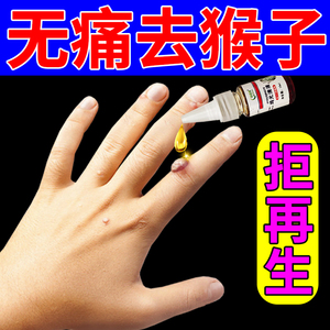 脚肉刺肉粒疙瘩跖疣瘊子净专用膏去根灵贴神器千年仲景同款货源