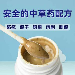 去瘊子药疣瘊灵肉刺鱼休子鱼鳞痣足部老茧拓疣寻常疣祛根神器草本