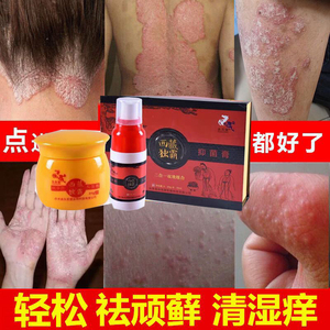 三珍清紫椒癣酊外用癣药膏牛皮癣藓断根湿疹皮肤瘙痒干燥止痒抑菌