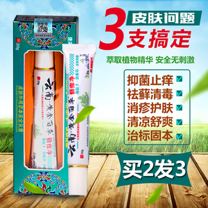 康夫康云南黄金百草藓痒净治皮肤瘙痒外用止痒药膏牛皮鲜银屑头藓
