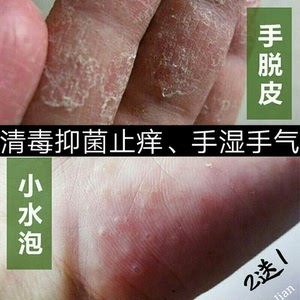 治手气的药止痒