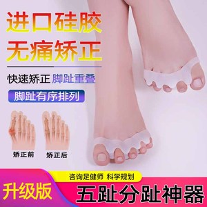 拇指外翻矫正器分大母脚趾头足改善纠正大脚骨可以穿鞋男女士分离