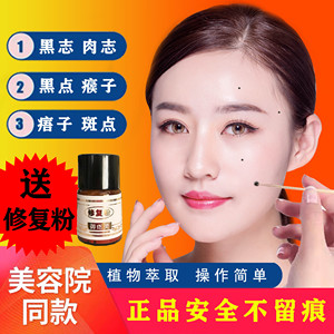 去痣点痣膏无痕正品脸部药水中药祛痣去志防疤去黑点除痣灵神器取