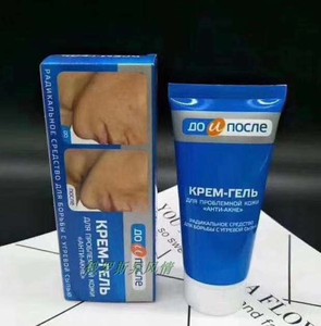 俄罗斯进口kpem本土蓝盒祛痘膏粉刺霜面部暗疮痘印青春痘50ml包邮