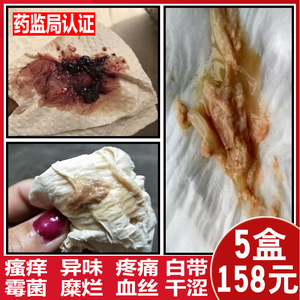 妇科抑菌凝胶正品反反复复霉菌性豆腐渣女阴道苦参金鸡护理炎私处