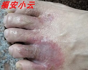 藏王癣痒灵