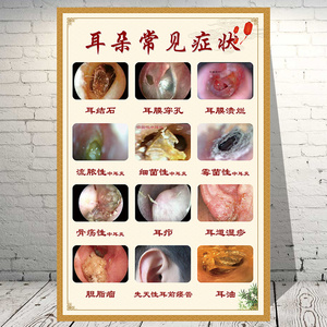 耳朵常见症状海报中医养生挂画经络理疗墙贴人体穴位结构挂图