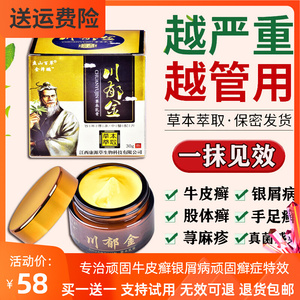 牛皮癣药膏治疗牛皮藓银屑病头皮癣特效皮炎湿疹止痒去根皮肤外用
