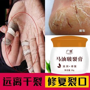 【冻疮膏云南白药】冻疮膏云南白药品牌,价格 - 阿里巴巴