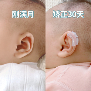 新生儿耳廓耳朵夹矫正器婴儿耳撑耳形外耳内扣固定垂耳贴硅胶幼儿