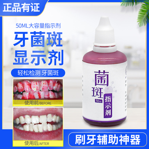 贝哥仕牙菌斑显示指示剂成人儿童口腔牙齿垢测试检查染色剂