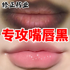 修正去除嘴唇周围黑色素嘴角暗沉发黑唇周唇嘴边唇纹去黑唇色淡化