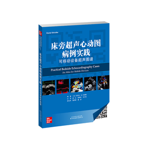 tb553463282淘宝床旁超声心动图病例实践可移动设备超声图谱美