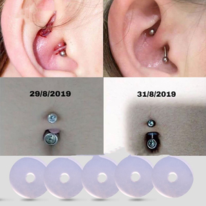 小飞碟防增生耳骨耳洞薄疤痕消除垫片食品级硅胶软脐钉耳钉防内陷