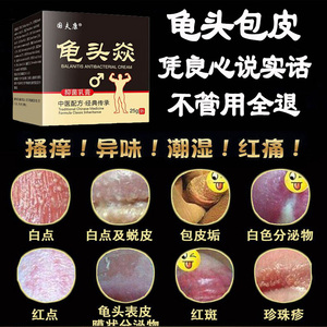 霉菌性包皮龟头炎专用药膏珍珠疹瘙痒红点阴茎肿消炎治疗男性喷剂