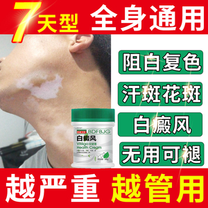 白癜风外用药白斑净专用克星促黑色素日本补骨脂酊花汗斑外用软膏