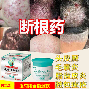 克林霉素磷酸酯凝胶10g治疗寻常痤疮外用药膏旗舰正品中港大药房