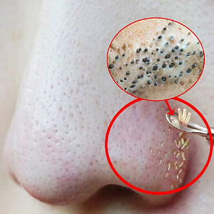 乳糖酸收缩毛孔精华原液深层清洁去黑头粉刺闭口堵塞疏通毛囊角化