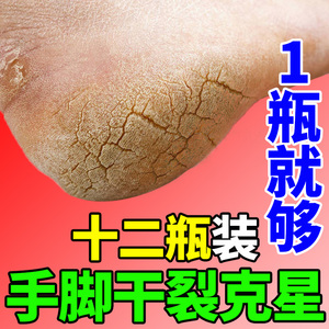 脚后跟干裂凡士林护手霜冻疮膏修复手足裂口治防裂开裂皱皴裂皲裂